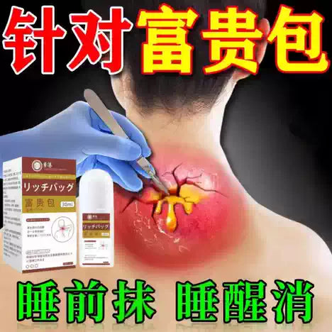 Herbal Comfort Roll-On
